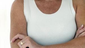 Brustkrebs: Dekollete einer Frau, Brustkrebs, Mammakarzinom