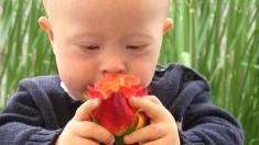 Down-Syndrom: Junge mit Trisomie 21, Down-Syndrom, Trisomie 21,
