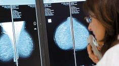 Mammografie-Screening: Röntgenbilder und Ärztin, Brustkrebs, Mammografie, Röntgen, Screening,