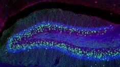 Nervenzellen; Epilepsie;, Epilepsie, Nervenzellen
