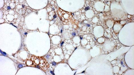 Braune Fettzellen inmitten von weißem Fettgewebe, braunes Fett, Fettgewebe, Weißes Fett