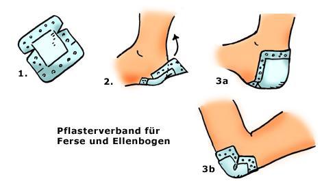 Tipps Pflaster für Wunden an Ferse oder Ellenbogen NetDoktor.de