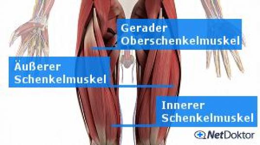 Muskelkater Geht Nicht Weg Ursachen www.netdoktor.de