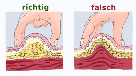 Die Impotenz in der Jugend
