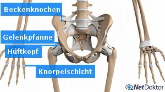 Gelenkschmerzen - Ursachen und Tipps - NetDoktor.de